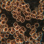 Dunkelfeld-Mikroskopie Blutbild